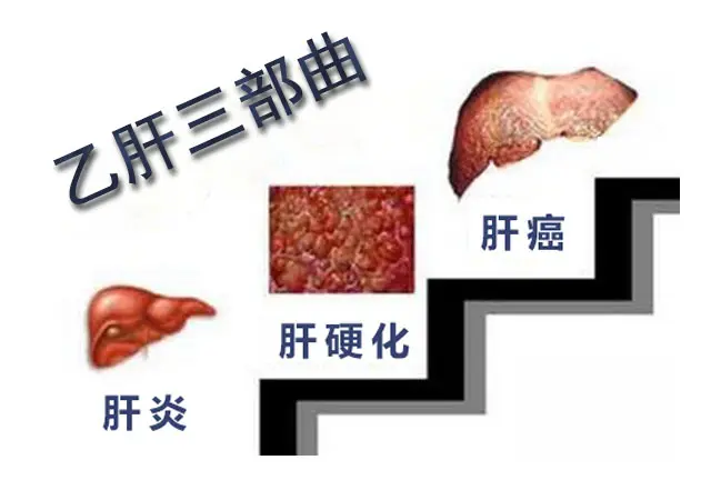 健康人感染乙肝的幾率是多少？